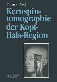 Cover image for Kernspintomographie Der Kopf-Hals-Region: Funktionelle Topographie -- Klinische Befunde -- Bildgebung -- Spektroskopie