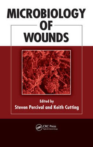 Cover image for Microbiology of Wounds