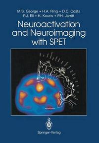 Cover image for Neuroactivation and Neuroimaging with SPET