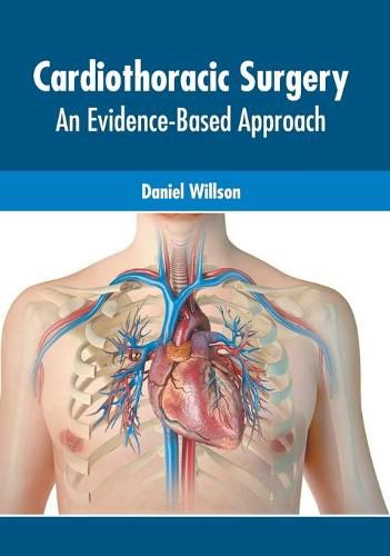 Cover image for Cardiothoracic Surgery: An Evidence-Based Approach