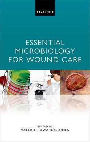 Cover image for Essential Microbiology for Wound Care