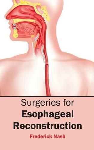 Cover image for Surgeries for Esophageal Reconstruction