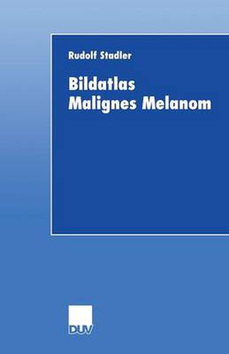 Cover image for Bildatlas Malignes Melanom