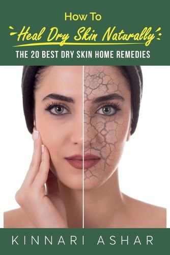 Cover image for How to Heal Dry Skin Naturally
