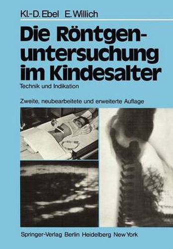 Cover image for Die Rontgenuntersuchung im Kindesalter