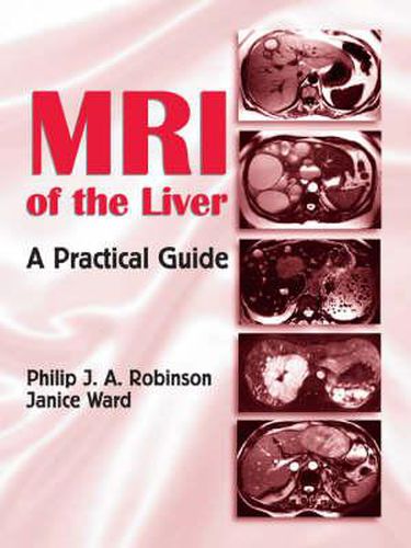 Cover image for MRI of the Liver: A Practical Guide