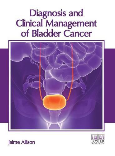 Cover image for Diagnosis and Clinical Management of Bladder Cancer