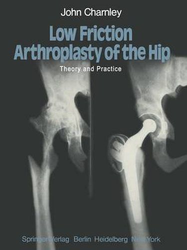 Cover image for Low Friction Arthroplasty of the Hip: Theory and Practice