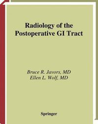 Cover image for Radiology of the Postoperative GI Tract