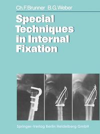 Cover image for Special Techniques in Internal Fixation