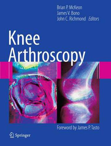 Cover image for Knee Arthroscopy