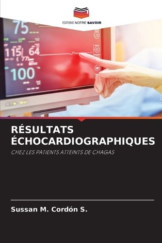Cover image for Resultats Echocardiographiques