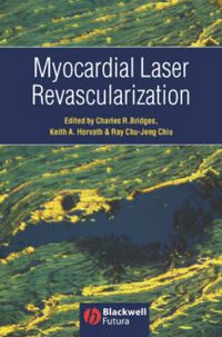 Cover image for Myocardial Laser Revascularization