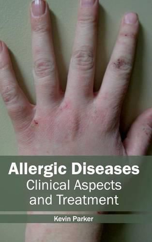 Cover image for Allergic Diseases: Clinical Aspects and Treatment