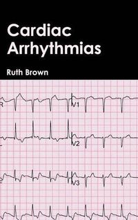 Cover image for Cardiac Arrhythmias