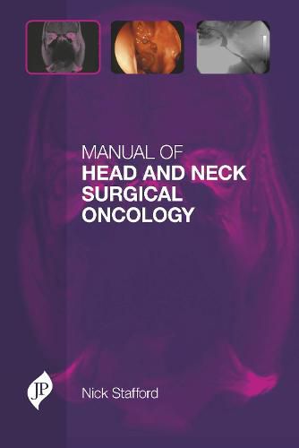 Cover image for Manual of Head and Neck Surgical Oncology