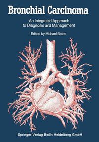 Cover image for Bronchial Carcinoma: An Integrated Approach to Diagnosis and Management