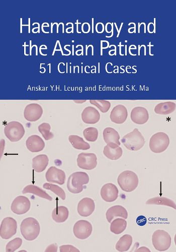 Cover image for Haematology and the Asian Patient