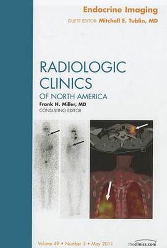 Cover image for Endocrine Imaging, An Issue of Radiologic Clinics of North America