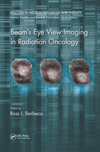 Cover image for Beam's Eye View Imaging in Radiation Oncology