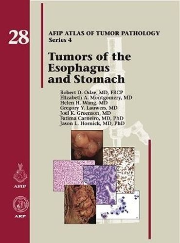 Cover image for Tumors of the Esophagus and Stomach