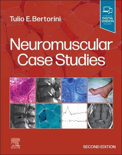 Cover image for Neuromuscular Case Studies