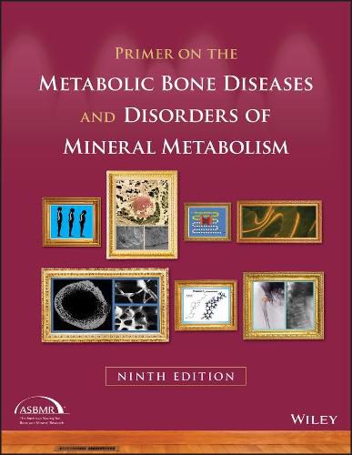 Primer on the Metabolic Bone Diseases and Disorders of Mineral Metabolism, 9th Edition