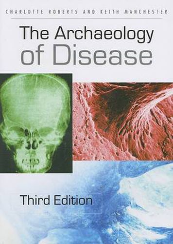 Cover image for The Archaeology of Disease