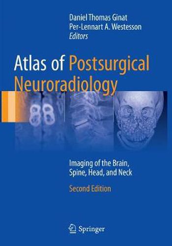 Cover image for Atlas of Postsurgical Neuroradiology: Imaging of the Brain, Spine, Head, and Neck