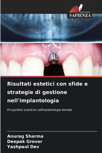 Cover image for Risultati estetici con sfide e strategie di gestione nell'implantologia