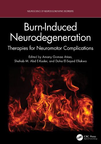 Cover image for Burn-Induced Neurodegeneration