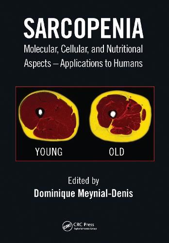 Cover image for Sarcopenia: Molecular, Cellular, and Nutritional Aspects - Applications to Humans