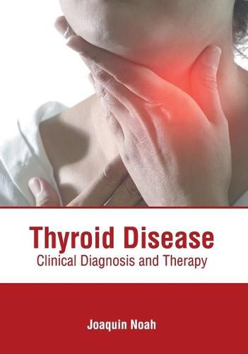 Cover image for Thyroid Disease: Clinical Diagnosis and Therapy