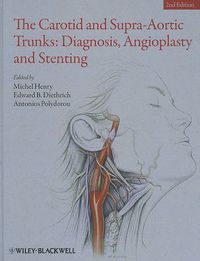 Cover image for The Carotid and Supra-Aortic Trunks: Diagnosis, Angioplasty and Stenting