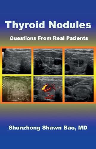 Cover image for Thyroid Nodules: Questions From Real Patients