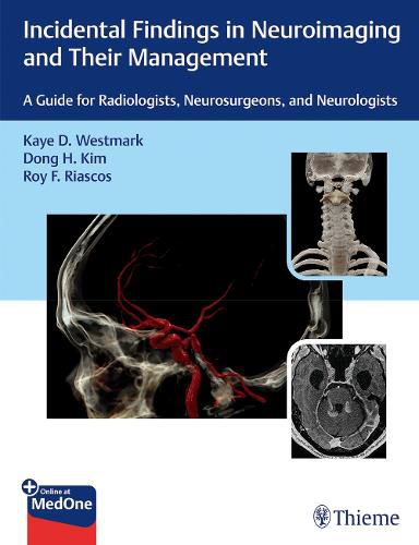 Cover image for Incidental Findings in Neuroimaging and Their Management: A Guide for Radiologists, Neurosurgeons, and Neurologists