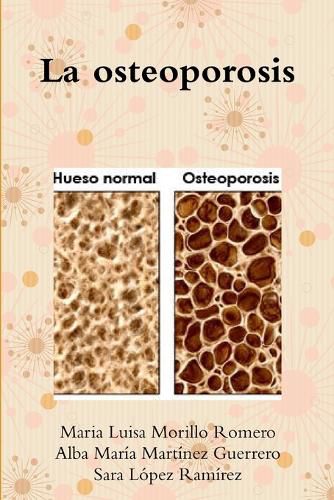 Cover image for La osteoporosis