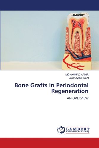 Cover image for Bone Grafts in Periodontal Regeneration