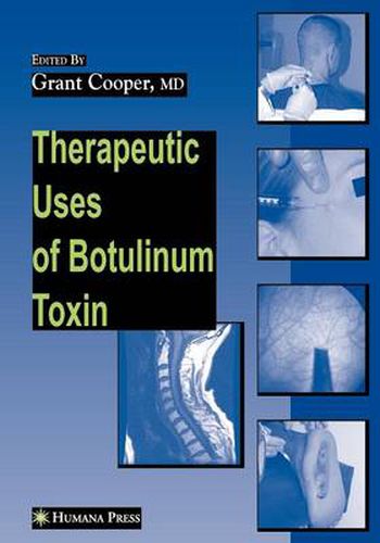 Cover image for Therapeutic Uses of Botulinum Toxin