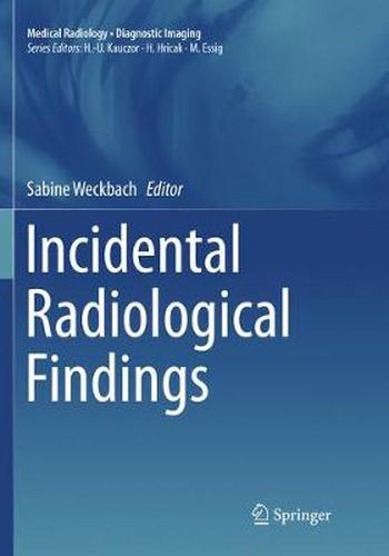 Cover image for Incidental Radiological Findings