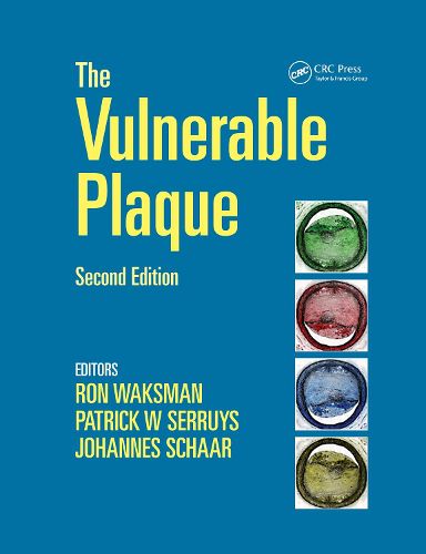 Cover image for Handbook of the Vulnerable Plaque