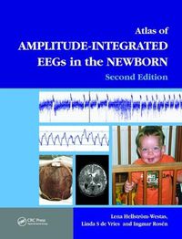 Cover image for An Atlas of Amplitude-Integrated EEGs in the Newborn