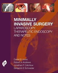 Cover image for Minimally Invasive Surgery: Laparoscopy, Therapeutic Endoscopy and NOTES