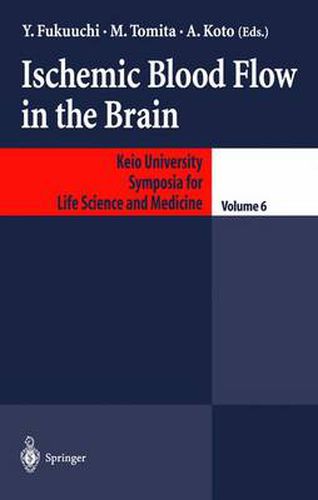 Cover image for Ischemic Blood Flow in the Brain