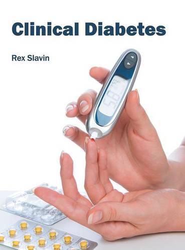 Cover image for Clinical Diabetes