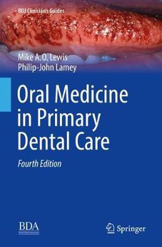 Cover image for Oral Medicine in Primary Dental Care