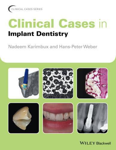 Cover image for Clinical Cases in Implant Dentistry