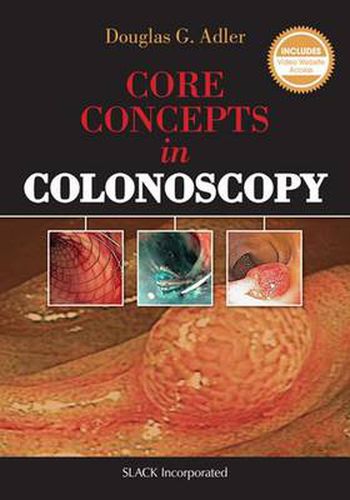 Cover image for Core Concepts in Colonoscopy