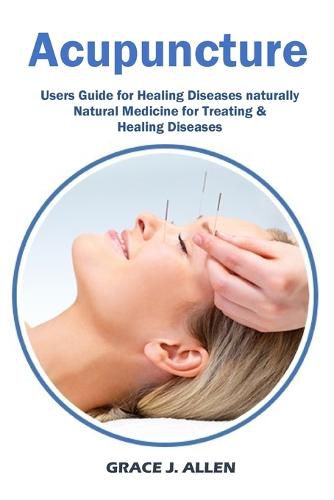 Cover image for Acupuncture: Users Guide for Healing Diseases naturally Natural Medicine for Treating & Healing Diseases