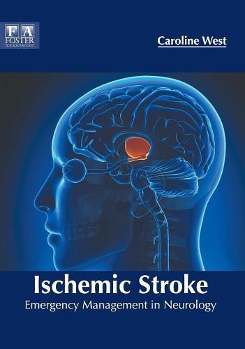 Cover image for Ischemic Stroke: Emergency Management in Neurology